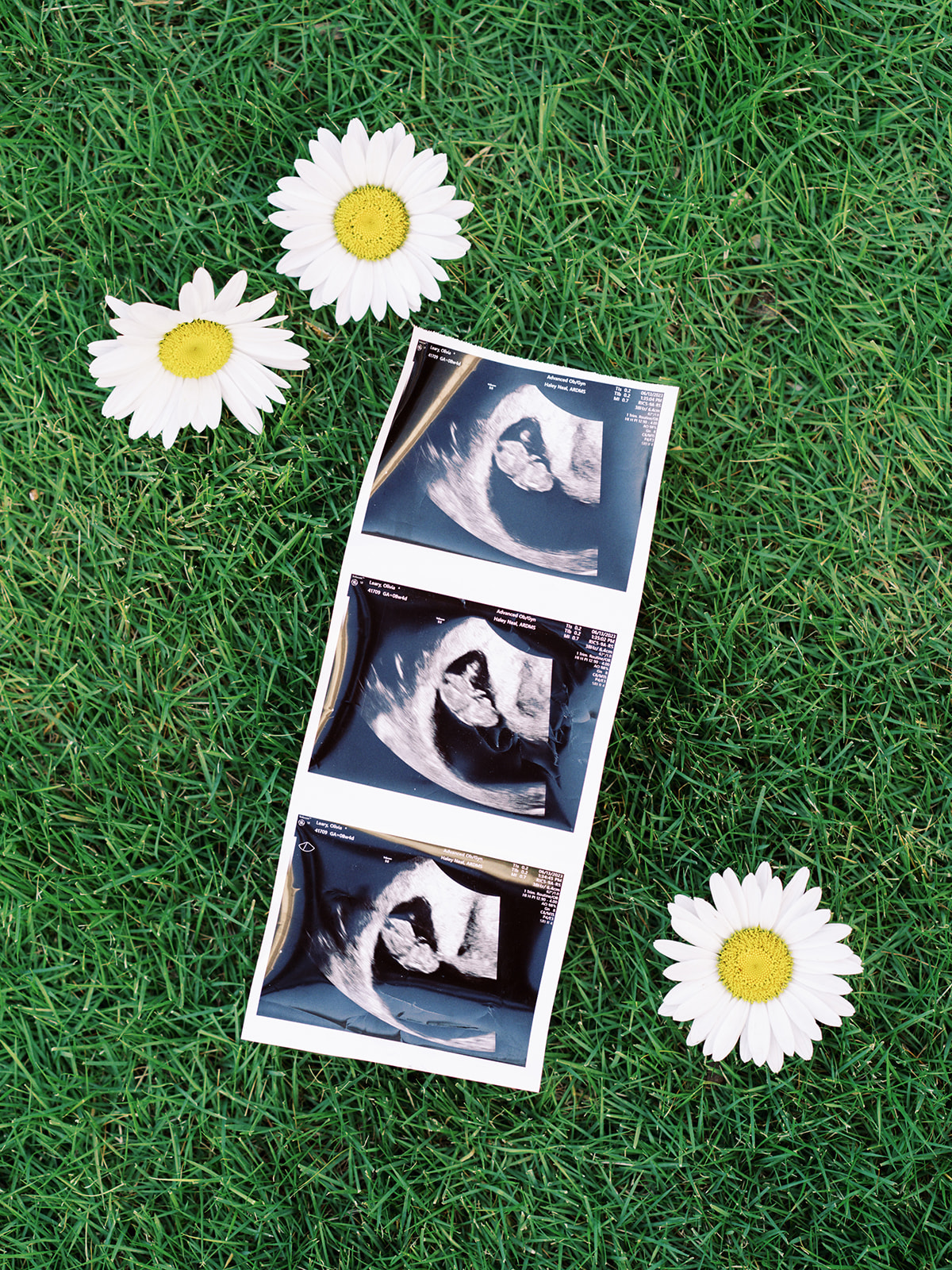 A few ultrasound snaps to announce a surprise pregnancy in a vibrant garden with flowers by Huntsville photographer